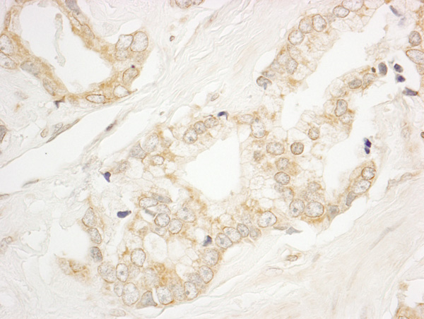 Immunohistochemistry (Formalin/PFA-fixed paraffin-embedded sections) - Anti-BIG1 antibody (AB72061), expandable thumbnail