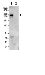 Immunoprecipitation - Anti-BIG1 antibody (AB72061)