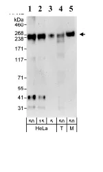 Western blot - Anti-BIG1 antibody (AB72061)