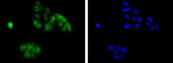 Immunocytochemistry/ Immunofluorescence - Anti-BIG1 antibody [EPR10046(2)] - BSA and Azide free (AB250707)