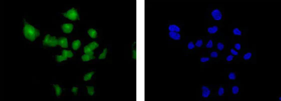 Immunocytochemistry/ Immunofluorescence - Anti-BIG1 antibody [EPR10046(2)] - BSA and Azide free (AB250707)