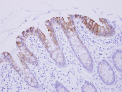 Immunohistochemistry (Formalin/PFA-fixed paraffin-embedded sections) - Anti-Biglycan antibody (AB226991)