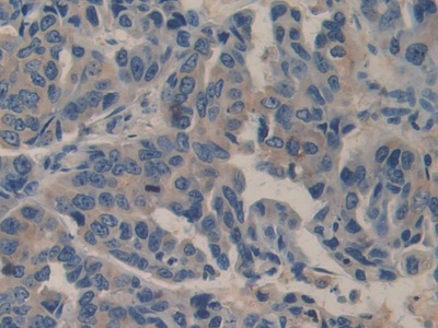 Immunohistochemistry (Formalin/PFA-fixed paraffin-embedded sections) - Anti-Biglycan antibody (AB231297)