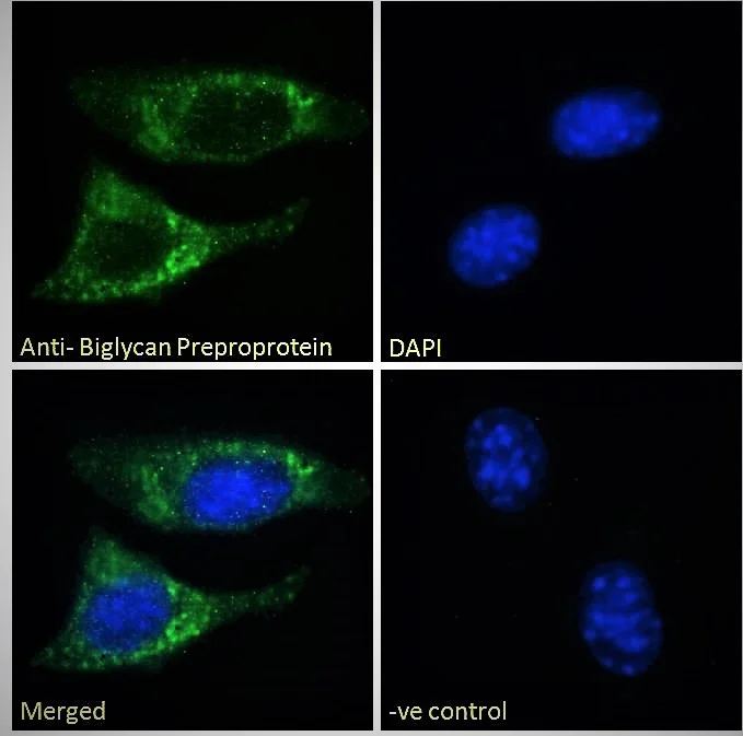 Immunocytochemistry - Anti-Biglycan antibody (AB58562)