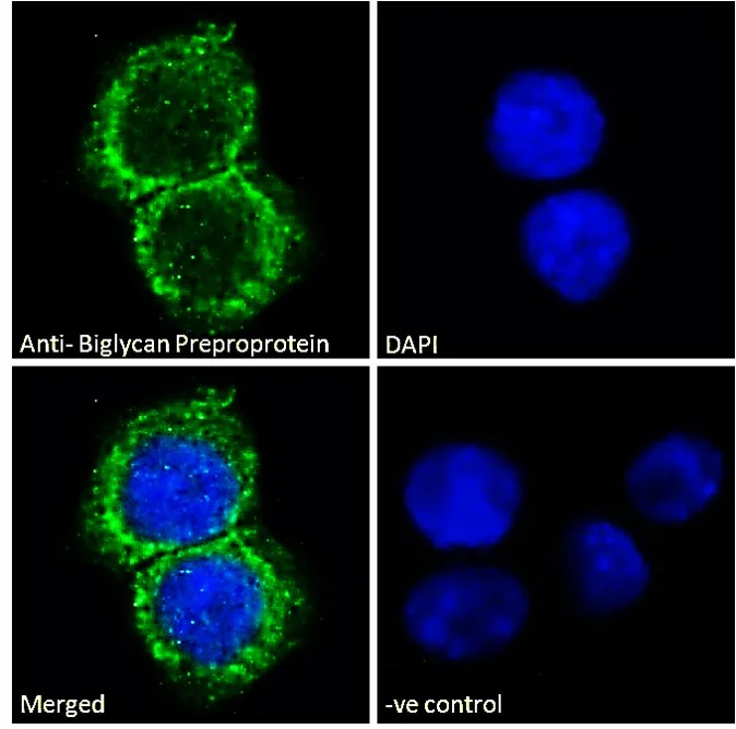 Immunocytochemistry - Anti-Biglycan antibody (AB58562)