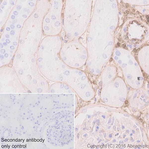 Immunohistochemistry (Formalin/PFA-fixed paraffin-embedded sections) - Anti-Biglycan antibody [EPR20235] (AB209234)