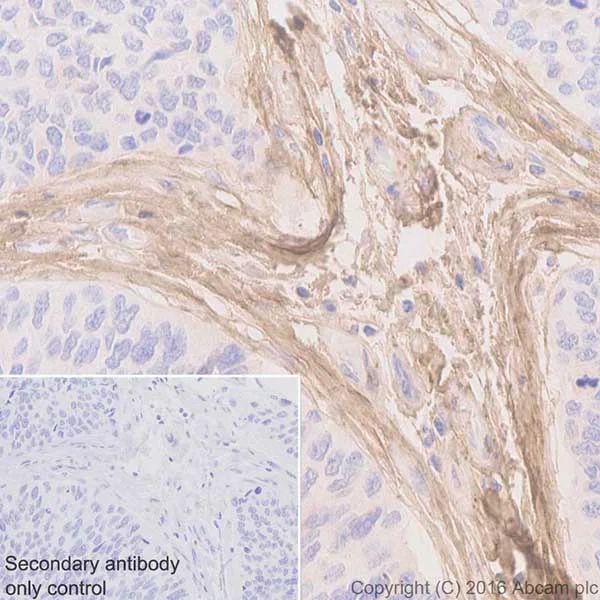 Immunohistochemistry (Formalin/PFA-fixed paraffin-embedded sections) - Anti-Biglycan antibody [EPR20235] (AB209234)