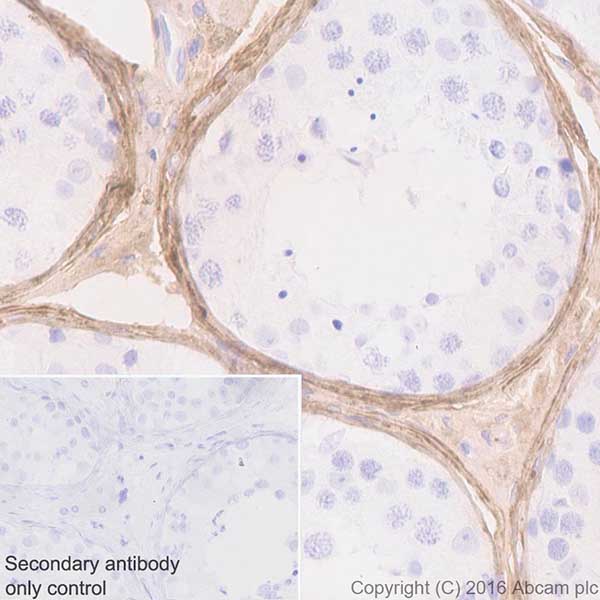 Anti-Biglycan antibody [EPR20235]
