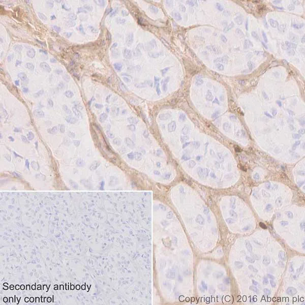 Immunohistochemistry (Formalin/PFA-fixed paraffin-embedded sections) - Anti-Biglycan antibody [EPR20235] - BSA and Azide free (AB251501)