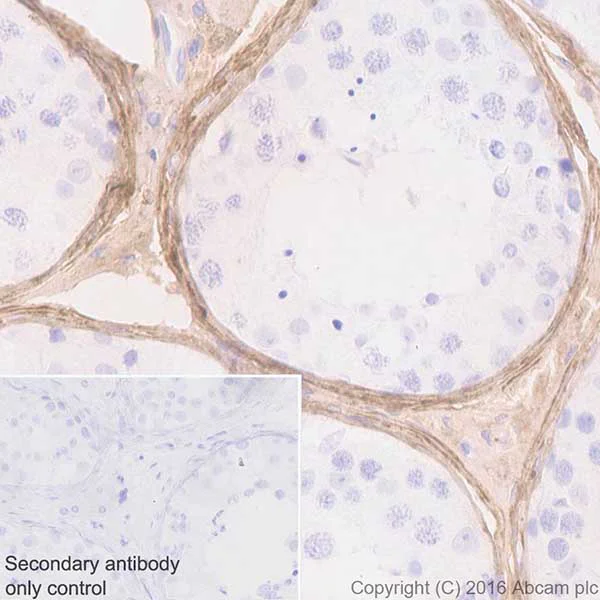 Immunohistochemistry (Formalin/PFA-fixed paraffin-embedded sections) - Anti-Biglycan antibody [EPR20235] - BSA and Azide free (AB251501)