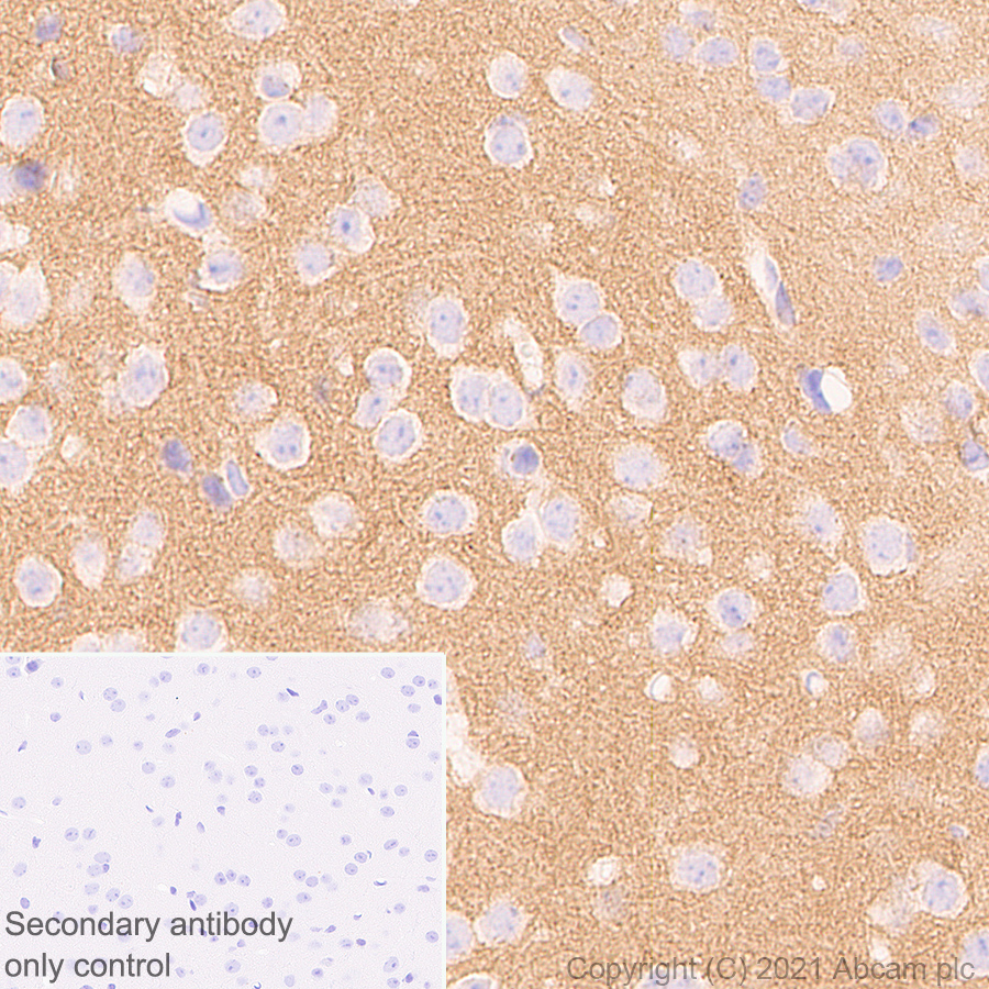 Immunohistochemistry (Formalin/PFA-fixed paraffin-embedded sections) - Anti-BIII antibody [EPR25384-127] - BSA and Azide free (AB288162), expandable thumbnail