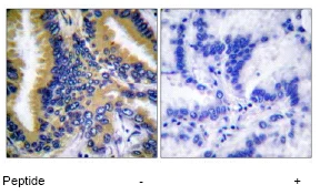 Immunohistochemistry (Formalin/PFA-fixed paraffin-embedded sections) - Anti-Bik antibody (AB52182)