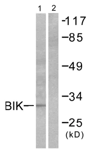 Western blot - Anti-Bik antibody (AB52182)