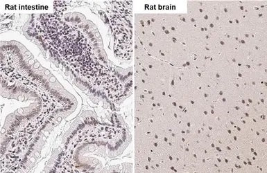 Immunohistochemistry (Formalin/PFA-fixed paraffin-embedded sections) - Anti-Bile Acid Receptor/FXR antibody (AB228949)