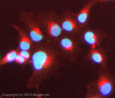 Immunocytochemistry/ Immunofluorescence - Anti-Bile Acid Receptor/FXR antibody (AB85606)