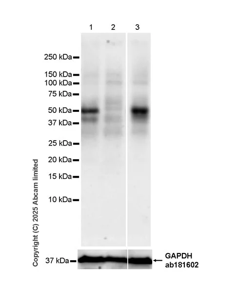 Western blot - Anti-Bile Acid Receptor/FXR antibody [EPR29793-33] (AB325493)