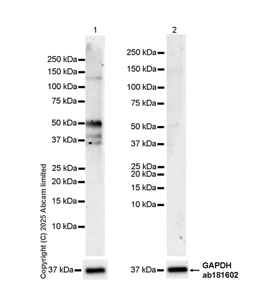 Western blot - Anti-Bile Acid Receptor/FXR antibody [EPR29793-33] (AB325493)
