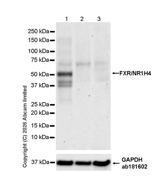 Western blot - Anti-Bile Acid Receptor/FXR antibody [EPR29793-33] (AB325493)