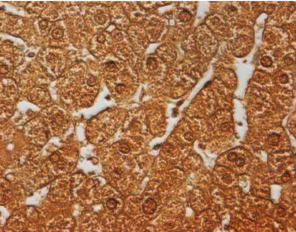 Immunohistochemistry (Formalin/PFA-fixed paraffin-embedded sections) - Anti-Bile Acid Receptor NR1H4 antibody [322.1.2.2] - N-terminal (AB187735)
