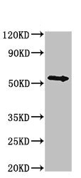 Western blot - Anti-Bile Acid Receptor NR1H4 antibody (AB235094), expandable thumbnail