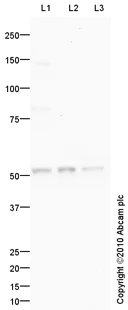 Western blot - Anti-Bile Acid Receptor NR1H4 antibody (AB85606)