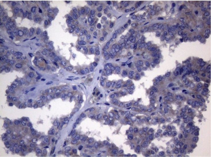 Immunohistochemistry (Formalin/PFA-fixed paraffin-embedded sections) - Anti-Bile Acid Receptor NR1H4 antibody [OTI4F12] - BSA and Azide free (AB273661), expandable thumbnail