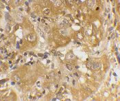 Immunohistochemistry (Formalin/PFA-fixed paraffin-embedded sections) - Anti-Bim antibody (AB7888)