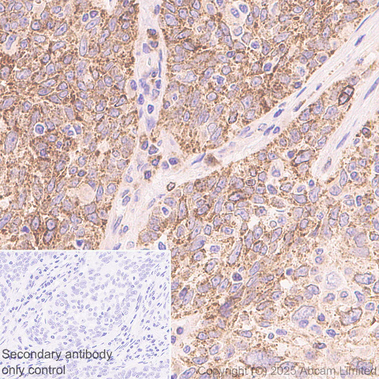 Immunohistochemistry (Formalin/PFA-fixed paraffin-embedded sections) - Anti-Bim antibody [Y36] - Mouse IgG2a (Chimeric) (AB324516)