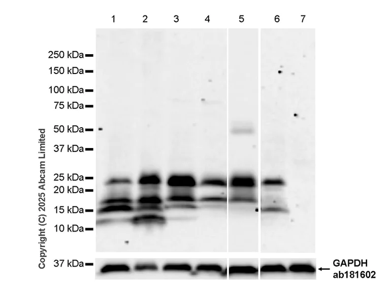 Western blot - Anti-Bim antibody [Y36] - Mouse IgG2a (Chimeric) (AB324516)