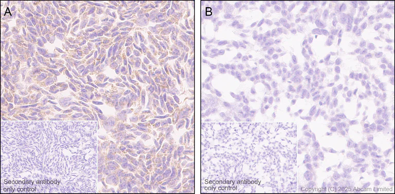 Immunohistochemistry (Formalin/PFA-fixed paraffin-embedded sections) - Anti-Bim antibody [Y36] - Mouse IgG2a (Chimeric) - BSA and Azide free (AB324661)