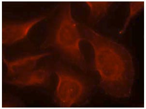 Immunocytochemistry/ Immunofluorescence - Anti-Bim (phospho S69) antibody (AB131477), expandable thumbnail