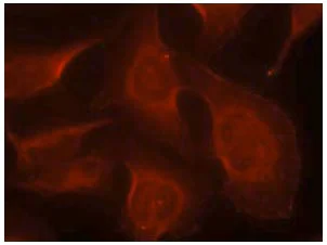 Immunocytochemistry/ Immunofluorescence - Anti-Bim (phospho S69) antibody (AB131477)