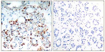 Immunohistochemistry (Formalin/PFA-fixed paraffin-embedded sections) - Anti-Bim (phospho S69) antibody (AB131477), expandable thumbnail