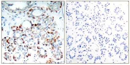 Immunohistochemistry (Formalin/PFA-fixed paraffin-embedded sections) - Anti-Bim (phospho S69) antibody (AB131477)