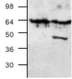 Western blot - Anti-BIN1 antibody (AB27796)
