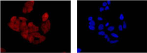Immunocytochemistry/ Immunofluorescence - Anti-BIN1 antibody [EPR13463-25] (AB185950), expandable thumbnail