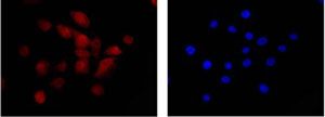 Immunocytochemistry/ Immunofluorescence - Anti-BIN1 antibody [EPR13463-25] (ab185950), expandable thumbnail