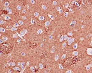 Immunohistochemistry (Formalin/PFA-fixed paraffin-embedded sections) - Anti-BIN1 antibody [EPR13463-25] (AB185950), expandable thumbnail