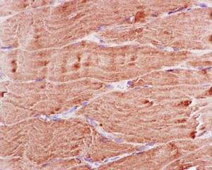 Immunohistochemistry (Formalin/PFA-fixed paraffin-embedded sections) - Anti-BIN1 antibody [EPR13463-25] (AB185950), expandable thumbnail