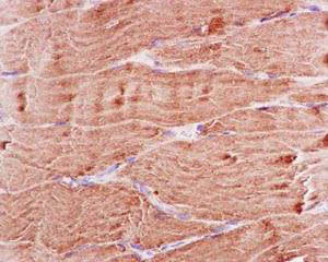 Immunohistochemistry (Formalin/PFA-fixed paraffin-embedded sections) - Anti-BIN1 antibody [EPR13463-25] (AB185950)
