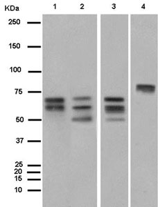 Western blot - Anti-BIN1 antibody [EPR13463-25] (ab185950), expandable thumbnail