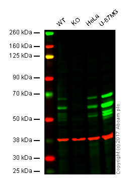 Western blot - Anti-BIN1 antibody [EPR13463-25] (AB185950), expandable thumbnail