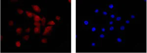 Immunocytochemistry/ Immunofluorescence - Anti-BIN1 antibody [EPR13463-25] - BSA and Azide free (AB226006)