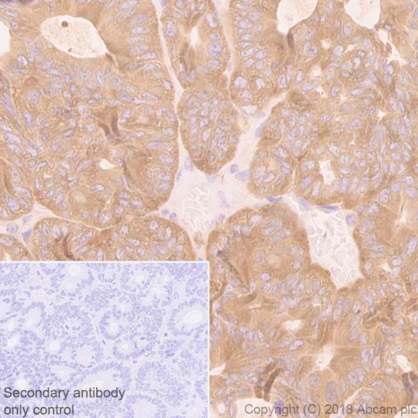Immunohistochemistry (Formalin/PFA-fixed paraffin-embedded sections) - Anti-BIN1 antibody [EPR13463] (AB182562), expandable thumbnail