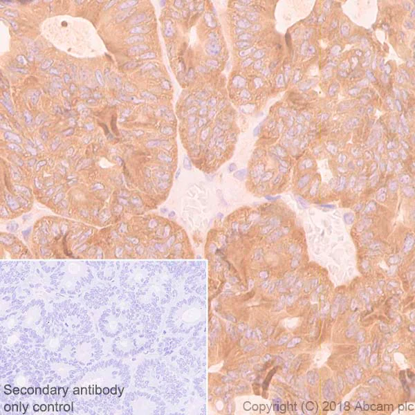 Immunohistochemistry (Formalin/PFA-fixed paraffin-embedded sections) - Anti-BIN1 antibody [EPR13463] (AB182562)