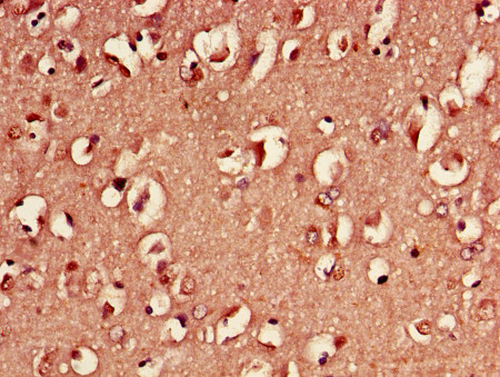Immunohistochemistry (Formalin/PFA-fixed paraffin-embedded sections) - Biotin Anti-14-3-3 eta/YWHAH antibody (AB193177)