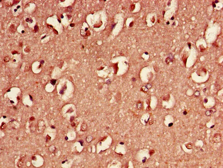 Immunohistochemistry (Formalin/PFA-fixed paraffin-embedded sections) - Biotin Anti-14-3-3 eta/YWHAH antibody (AB193177)