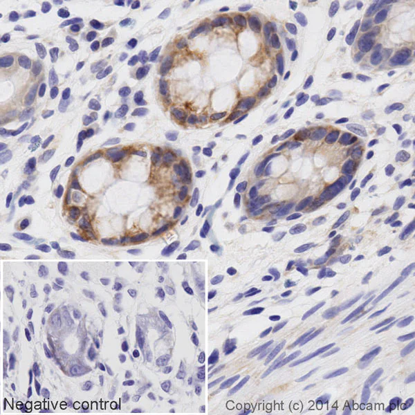 Immunohistochemistry (Formalin/PFA-fixed paraffin-embedded sections) - Biotin Anti-AIF antibody [E20] - Mitochondrial Marker (AB197526)