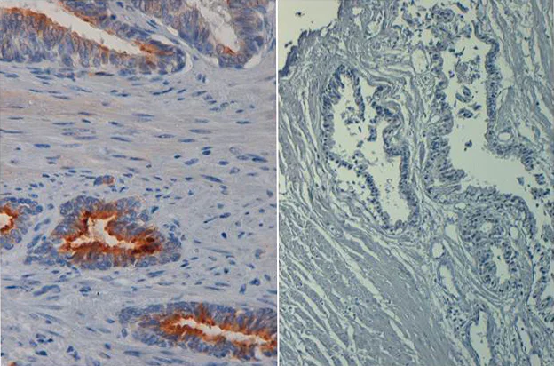 Immunohistochemistry (Formalin/PFA-fixed paraffin-embedded sections) - Biotin Anti-AKT1 (phospho S473) antibody [17F6.B11] (AB272113)