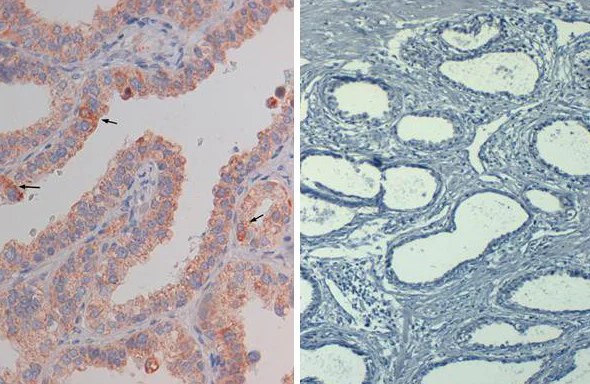 Immunohistochemistry (Formalin/PFA-fixed paraffin-embedded sections) - Biotin Anti-AKT1 (phospho S473) antibody [17F6.B11] (AB272113)